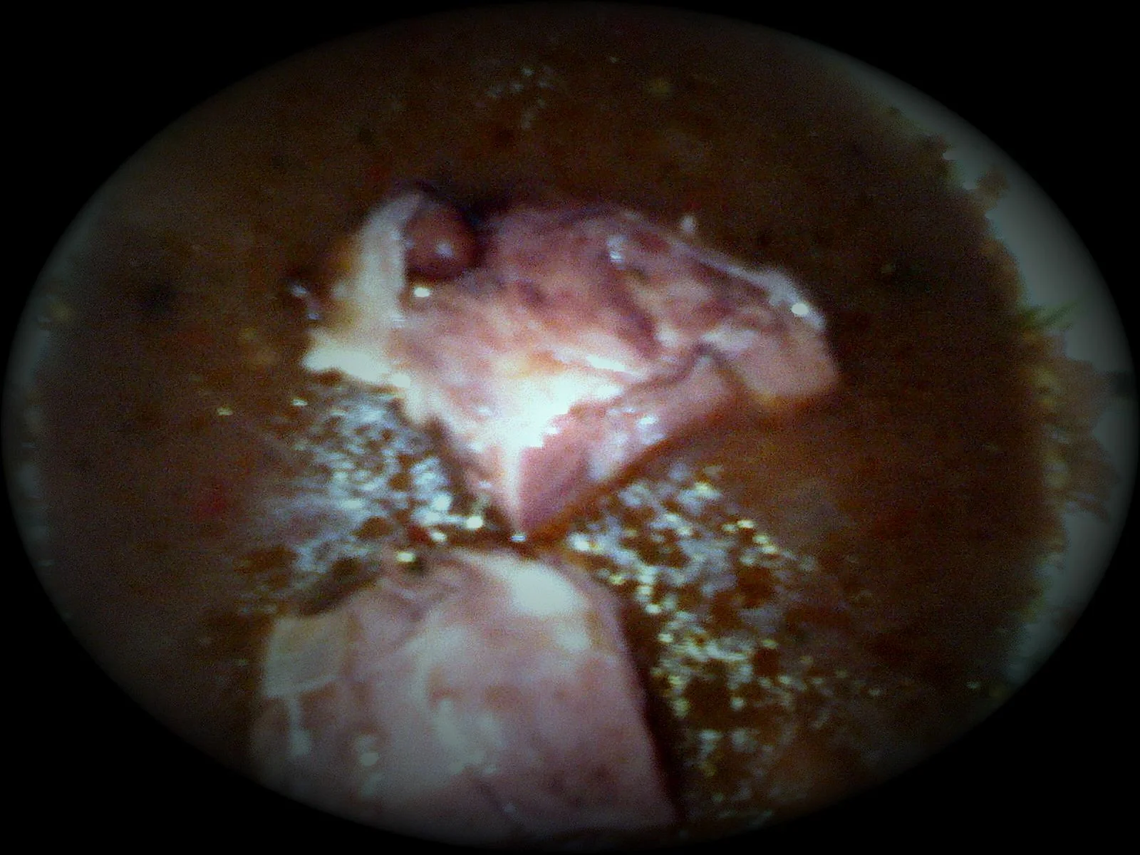 Bean soup with smoked ham hock